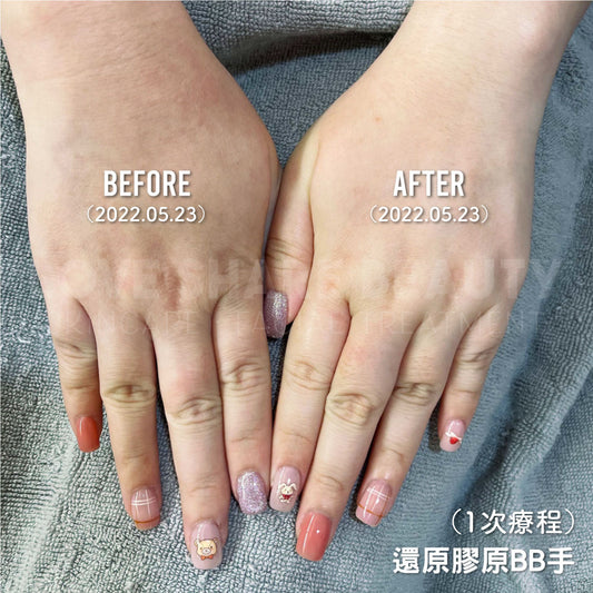 妙手回春療程(單次)