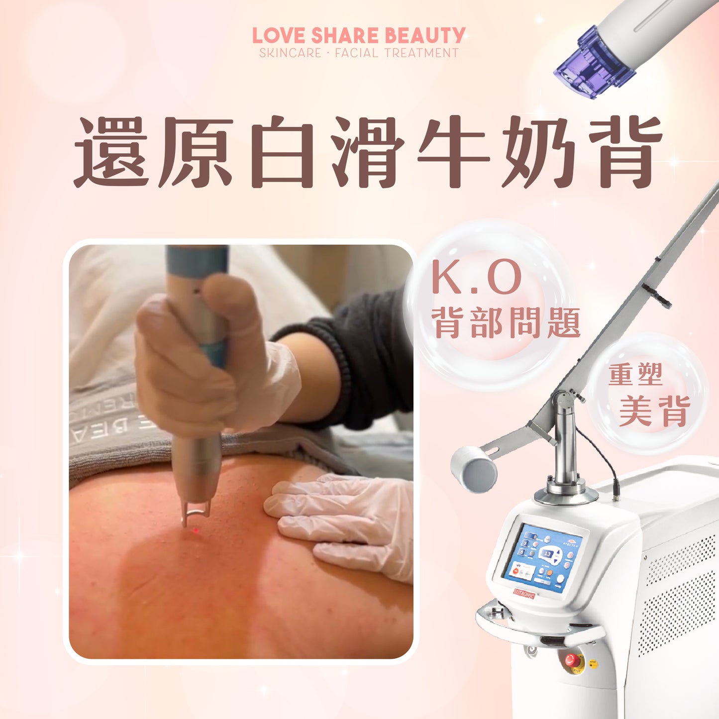 還原白滑牛奶背療程(單次)