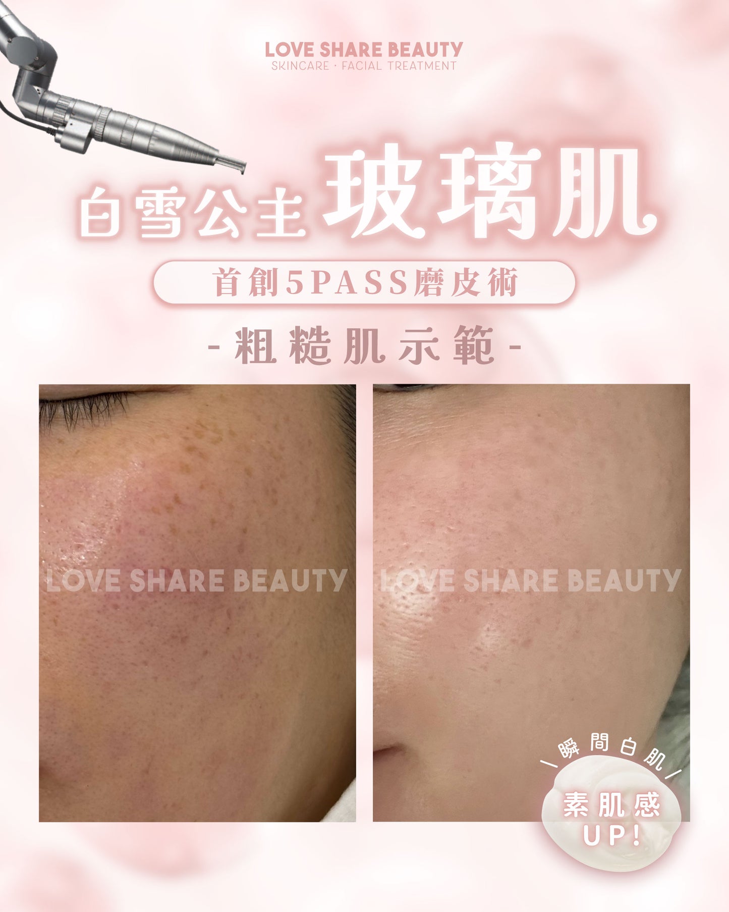 白雪公主玻璃肌